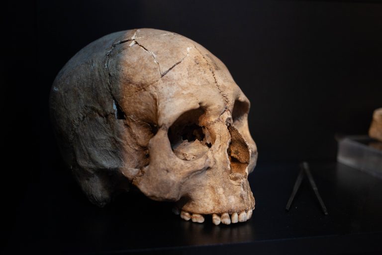 Skull in a museum case with tools next to it.